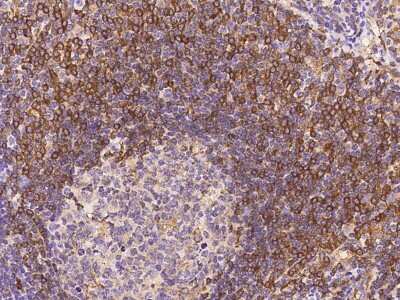 Immunohistochemistry-Paraffin: ABI3 Antibody [NBP2-97502]