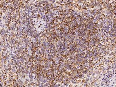 Immunohistochemistry-Paraffin: ABI3 Antibody [NBP2-97502]