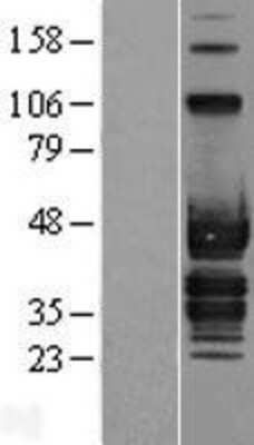 Western Blot: ABI3 Overexpression Lysate [NBP2-07046]