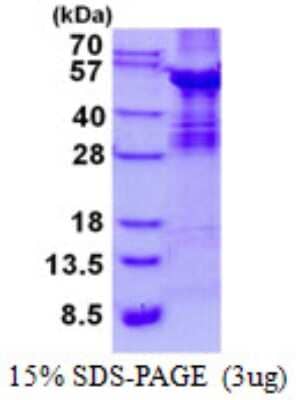 SDS-PAGE: Recombinant Human ABI3 His Protein [NBP2-22662]