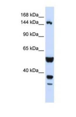 Western Blot: TARSH Antibody [NBP1-69394]