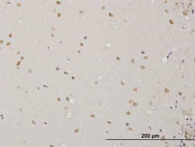 Immunohistochemistry-Paraffin: ABL2 Antibody (5C6) [H00000027-M09]