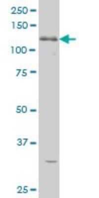 Western Blot: ABL2 Antibody (5C6) [H00000027-M09]