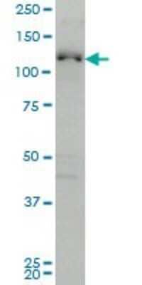 Western Blot: ABL2 Antibody (6D5) [H00000027-M03]