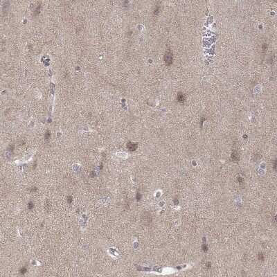 Immunohistochemistry-Paraffin: ABL2 Antibody [NBP2-68946]