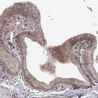 Immunohistochemistry-Paraffin: ABL2 Antibody [NBP2-68946]