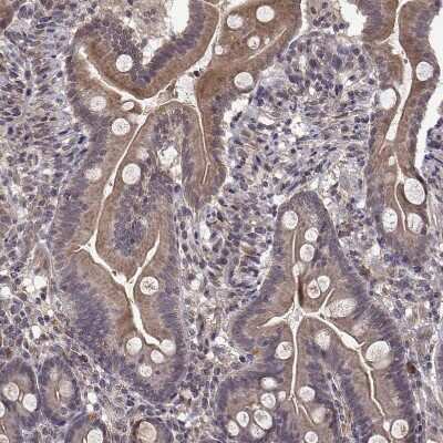 Immunohistochemistry-Paraffin: ABL2 Antibody [NBP2-68946]