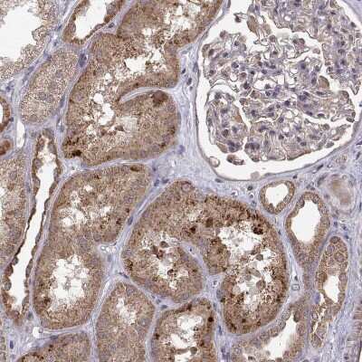 Immunohistochemistry-Paraffin: ABL2 Antibody [NBP2-68946]