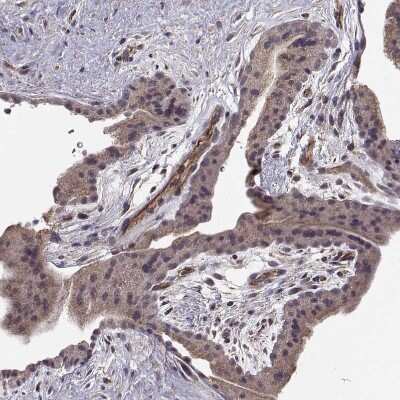 Immunohistochemistry-Paraffin: ABL2 Antibody [NBP2-68946]