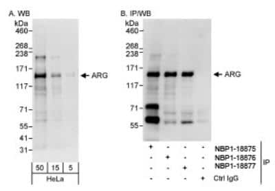 Western Blot: ABL2 Antibody [NBP1-18875]