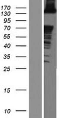 Western Blot: ABL2 Overexpression Lysate [NBL1-07210]