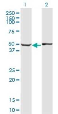 Western Blot: ABLIM1 Antibody (2C6) [H00003983-M06]