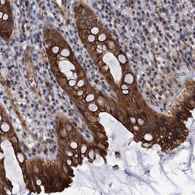 Immunohistochemistry-Paraffin: ABLIM1 Antibody [NBP1-89304]