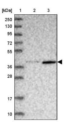 Western Blot: ABLIM1 Antibody [NBP1-89303]