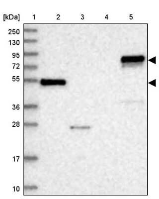 Western Blot: ABLIM1 Antibody [NBP1-89304]