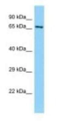 Western Blot: ABLIM1 Antibody [NBP1-98472]