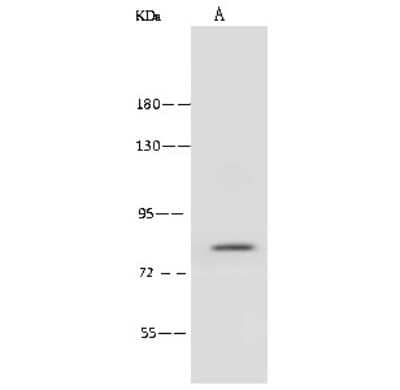 Western Blot: ABLIM1 Antibody [NBP2-99386]