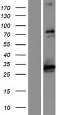 Western Blot: ABLIM1 Overexpression Lysate [NBP2-08127]