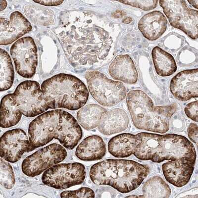 Immunohistochemistry-Paraffin: ABLIM2 Antibody [NBP1-81370]