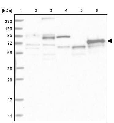 Western Blot: ABLIM2 Antibody [NBP1-81370]