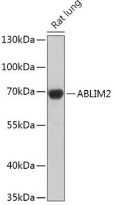 Western Blot: ABLIM2 AntibodyAzide and BSA Free [NBP2-92382]