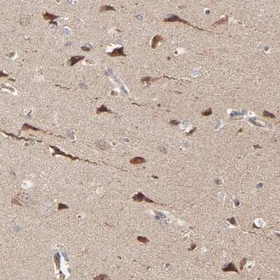 Immunohistochemistry-Paraffin: ABLIM3 Antibody [NBP1-81471]