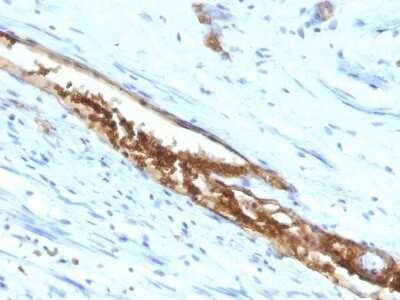 Immunohistochemistry-Paraffin: ABO, Blood Group A Antigen Antibody (3-3A) - Azide and BSA Free [NBP2-47872]