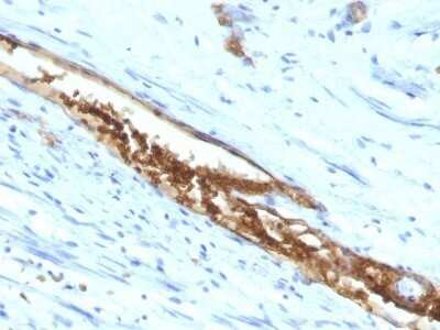 Immunohistochemistry-Paraffin: ABO, Blood Group A Antigen Antibody (3-3A) - IHC-Prediluted [NBP2-48069]