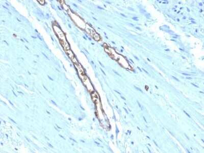 Immunohistochemistry-Paraffin: ABO, Blood Group A Antigen Antibody (HE-193) - Azide and BSA Free [NBP2-47869]