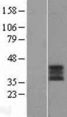 Western Blot: Blood Group B Transferase/GTB/ABO Overexpression Lysate [NBL1-07211]