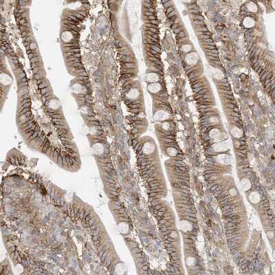 Immunohistochemistry-Paraffin: ABP1/AOC1 Antibody [NBP1-89067]