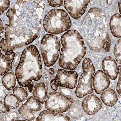 Immunohistochemistry-Paraffin: ABP1/AOC1 Antibody [NBP1-89067]