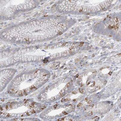 Immunohistochemistry-Paraffin: ABP1/AOC1 Antibody [NBP1-89067]
