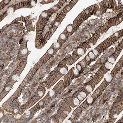 Immunohistochemistry-Paraffin: ABP1/AOC1 Antibody [NBP1-89068]