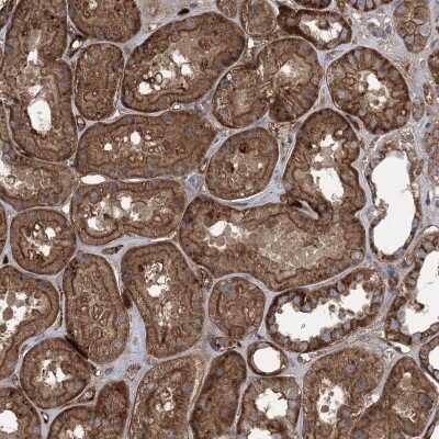 Immunohistochemistry-Paraffin: ABP1/AOC1 Antibody [NBP1-89068]