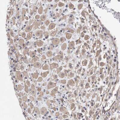 Immunohistochemistry-Paraffin: ABP1/AOC1 Antibody [NBP1-89068]