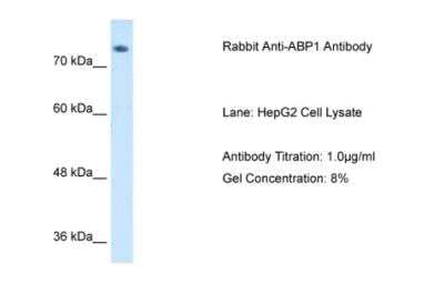 Western Blot: ABP1/AOC1 Antibody [NBP1-58006]