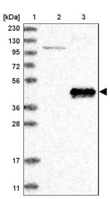 Western Blot: ABP1/AOC1 Antibody [NBP1-89067]