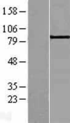 Western Blot: ABP1/AOC1 Overexpression Lysate [NBL1-07212]