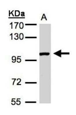 Western Blot: ABR Antibody [NBP1-30981]