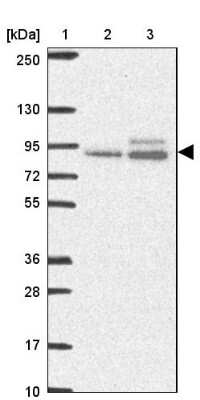 Western Blot: ABR Antibody [NBP2-49152]