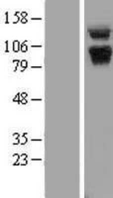 Western Blot: ABR Overexpression Lysate [NBP2-06496]