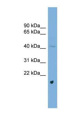 Western Blot: ABRA Antibody [NBP1-79505]