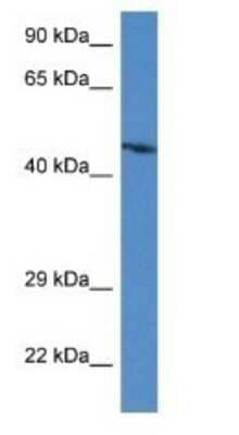 Western Blot: ABRA Antibody [NBP1-79506]