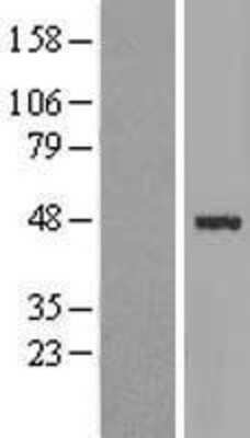 Western Blot: ABRA Overexpression Lysate [NBL1-07213]