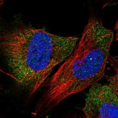 Immunocytochemistry/ Immunofluorescence: ABRO Antibody [NBP2-56296]