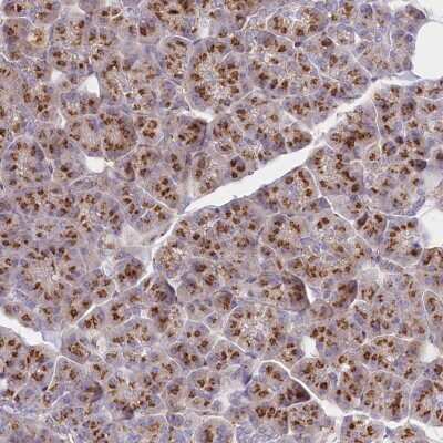 Immunohistochemistry: ABRO Antibody [NBP2-38355]