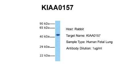 Western Blot: ABRO Antibody [NBP1-56788]