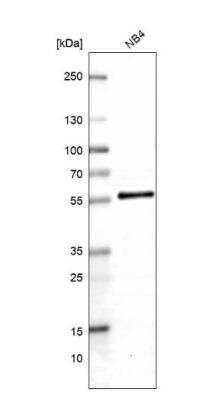 Western Blot: ABRO Antibody [NBP1-90282]