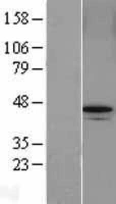 Western Blot: ABRO Overexpression Lysate [NBL1-10501]